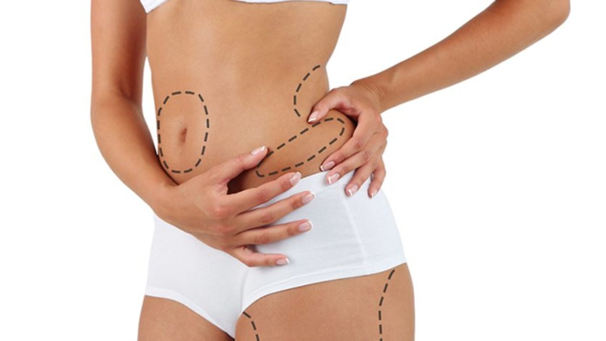 Body Jet Liposuction In Thailand